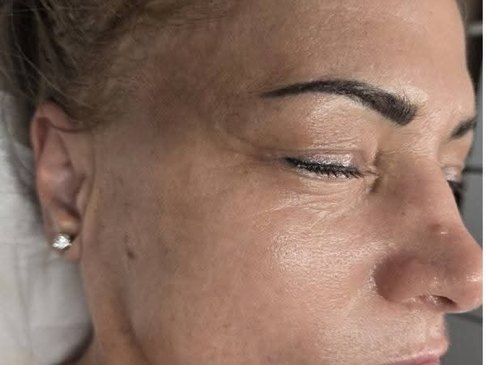 Anti-aging peptides feszesítés után